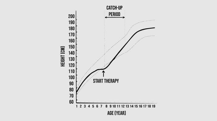 Catch up growth in prepubertal