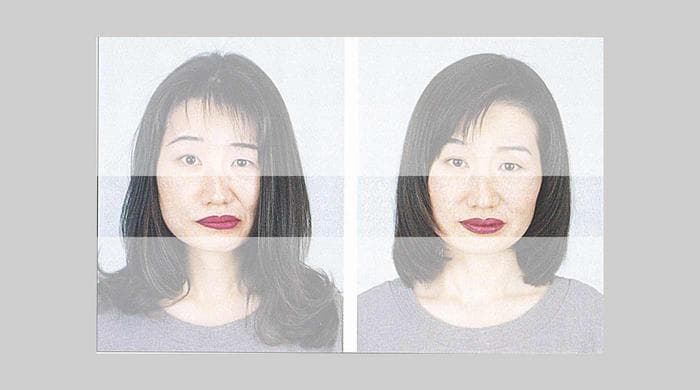 Корректирующий макияж у пациентки с лицевым параличом